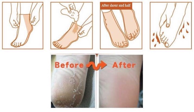 Mặt nạ lột da chết cho bàn chân Wonder One Shot One Kill Foot Peeling Pack Tonymoly