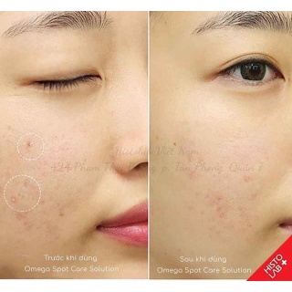 Kem Chấm Mụn Histolab Omega Spot Care Solution (12ml)