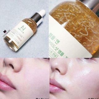 Serum dưỡng trắng