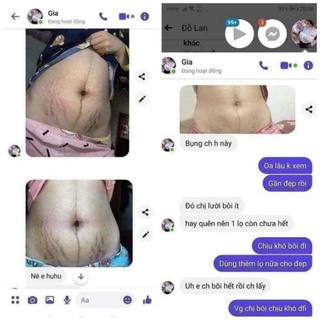 thảo mộc dưỡng da mờ rạn ,mờ thâm sẹo ,nứt da TKH