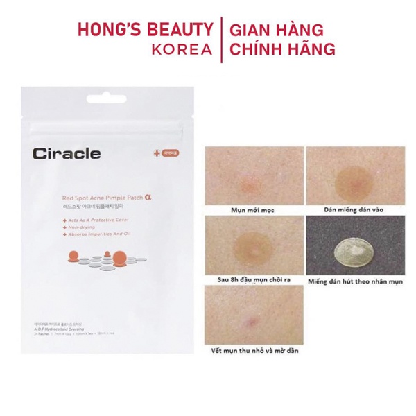 Miếng dán mụn Ciracle Red Spot Ance PimpLe 24 miếng - HONGS BEAUTY