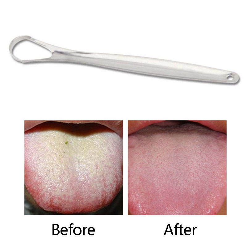 [Hàng mới về] Dụng cụ vệ sinh lưỡi bằng thép không gỉ