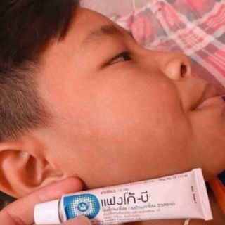 Kem bôi lang ben FANGO-B Thái Lan