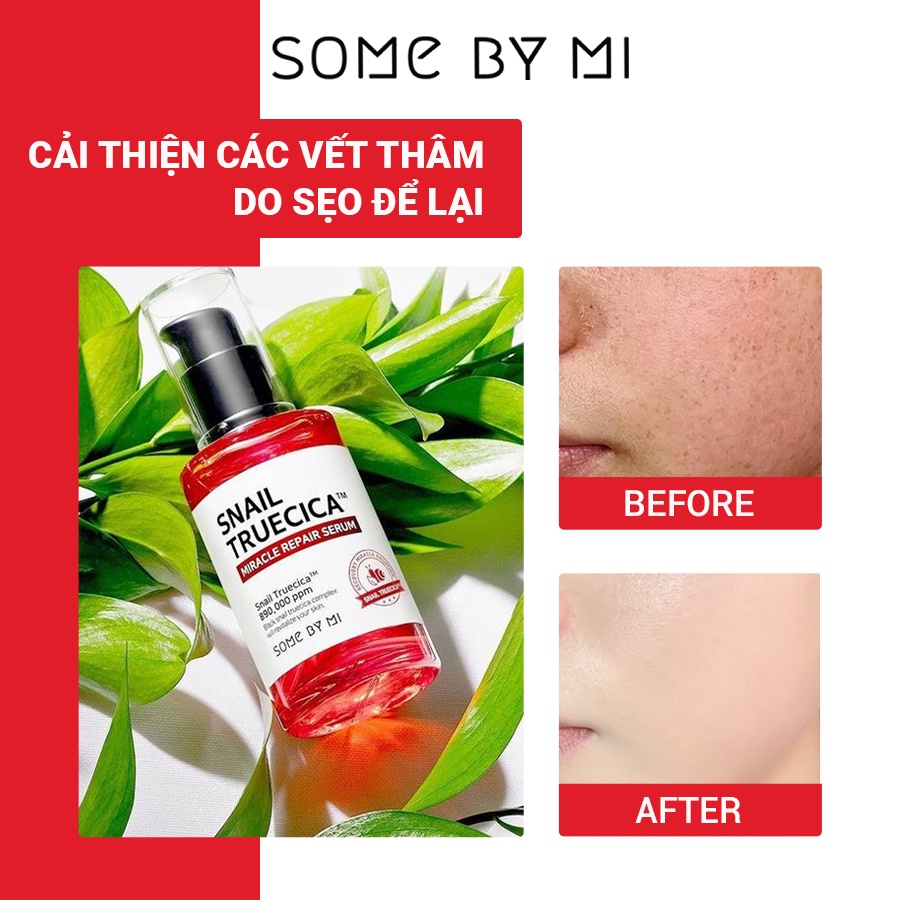 Tinh chất ốc sên đen cải Thiện sẹo mụn Some By Mi Snail Truecica Miracle Repair 50ml