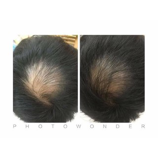 TINH DẦU BƯỞI NGUYÊN CHẤT 100%