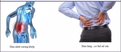 DẦU NÓNG ICYHOT DẠNG  SÁP &amp; LĂN (2025)