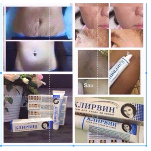 ( HÀNG AUTH ) KEM SẸO KLIRVIN NGA | BigBuy360 - bigbuy360.vn