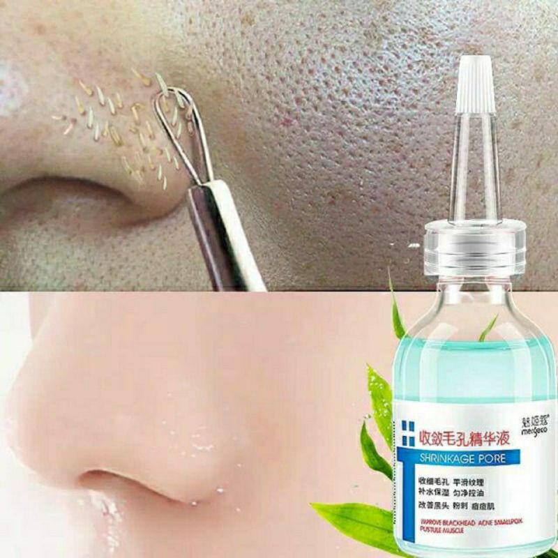 [RẺ VÔ ĐỊCH]Tinh Chất Shrinkage Pore Dưỡng Da Thu Nhỏ lỗ Chân Lông 30ml