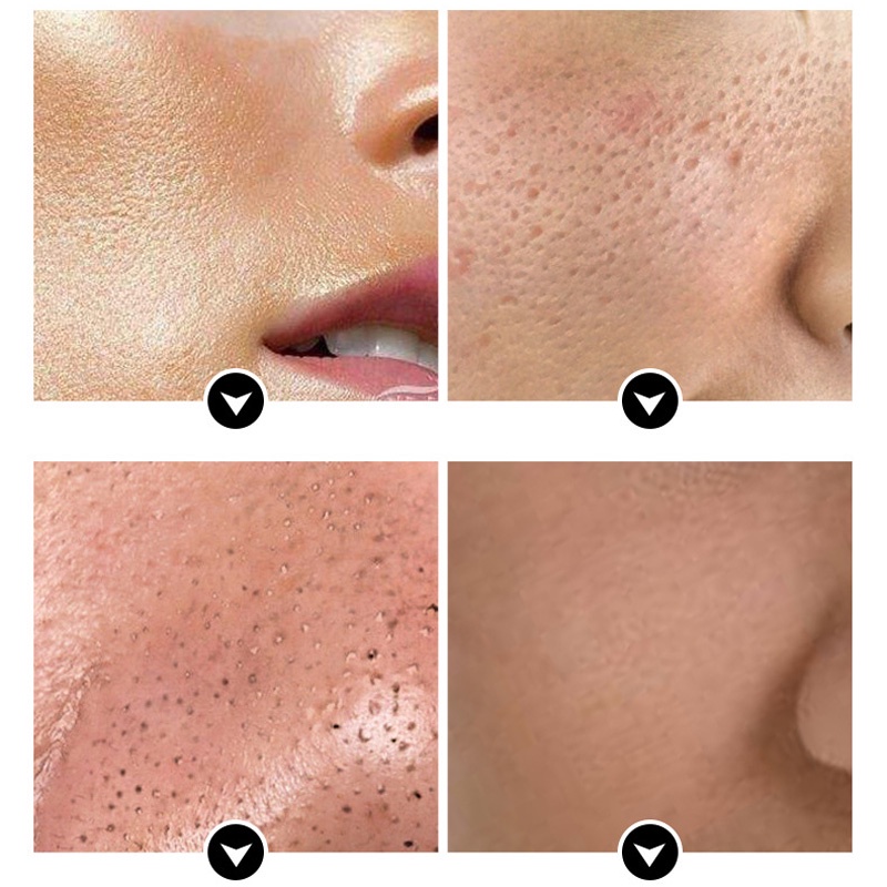 [Hàng mới về] Sữa rửa mặt SENANA dưỡng ẩm làm sạch sâu chống tàn nhang