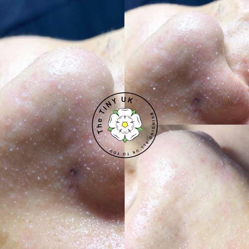 Ủ mụn đầu đen Medipeel 50ml | BigBuy360 - bigbuy360.vn