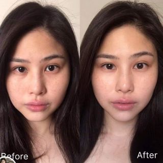 TINH CHẤT VITAMIN C NGUYÊN CHẤT CLINIQUE