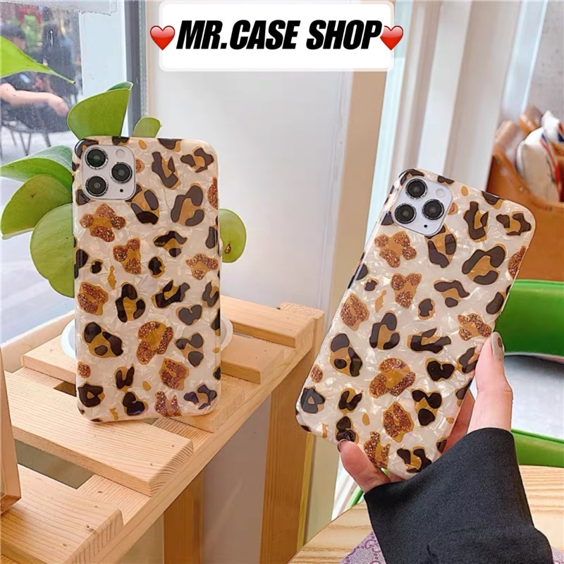 Case iPhone Da Beo Dẻo Dành Cho 12Promax/12/11Promax/Xsmax/X/Xs/7Plus/8Plus  - Mr.CAse