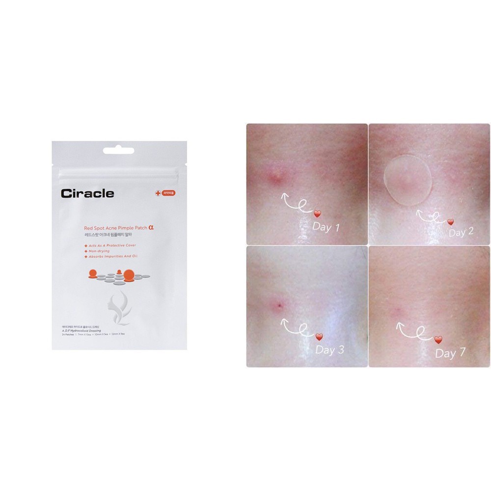 Miếng dán ngăn ngừa mụn Ciracle Red Spot Acne Pimple Path 24 Miếng