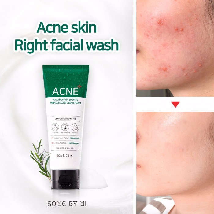 Some By Mi / Sữa Rửa Mặt giảm Mụn Some By Me AHA-BHA-PHA 30 Days Miracle Acne Clear Foam
