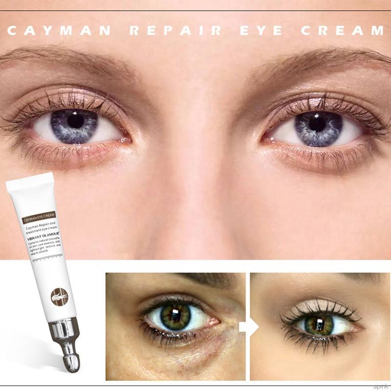 Kem Cá Sấu Dưỡng Ẩm Loại Bỏ Quầng Thâm Và Nếp Nhăn Cho Vùng Da Quanh