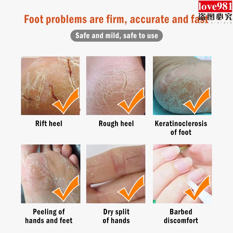 Kem dưỡng ẩm chống nứt nẻ tinh dầu chuối cao cấp | BigBuy360 - bigbuy360.vn