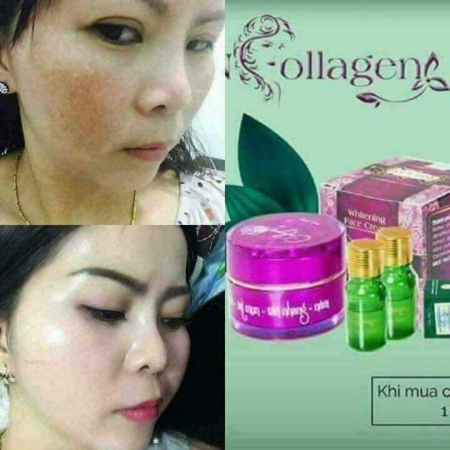 Kem face n collagen