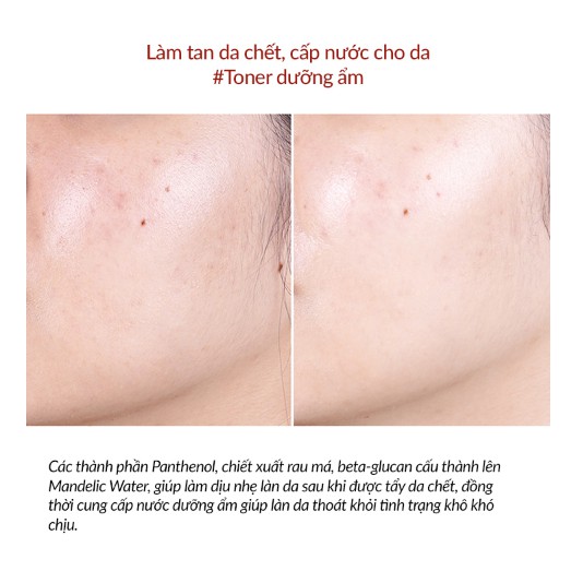 Toner ẩm làm sạch da chết - By Wishtrend Mandelic Acid 5% Skin Prep Water 120ml