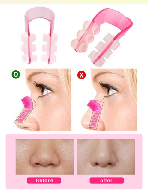 Kẹp nâng mũi Nose Up Nhật Bản 