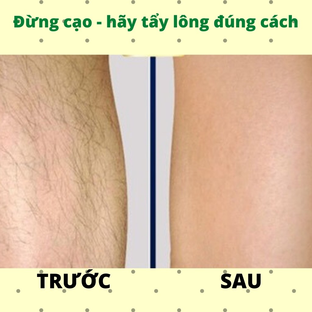 Kem tẩy lông Veet Pháp Minima 200ml, wax lông nách, chân tay, bikini cho da nhạy cảm, triệt lông toàn thân, kem dưỡng da