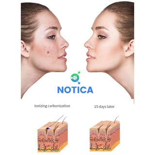 MÁY ĐỐT NỐT RUỒI,MỤN THỊT,XÓA XĂM
