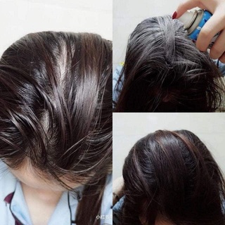 Dầu Gội Khô Batiste