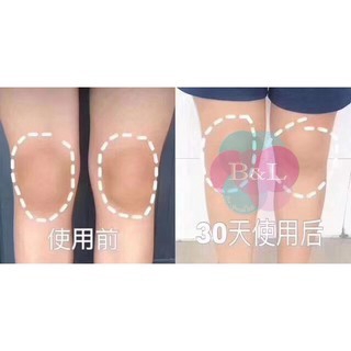 Xà Phòng Nâng Mông Chiết Xuất Đào Chống Melanin Tẩy Tế Bào Chết 80g | BigBuy360 - bigbuy360.vn