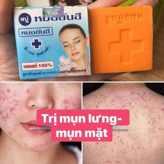 Xà Phòng ngừa mụn Thái Lan