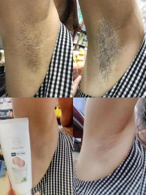 Kem triệt lông râu vĩnh viễn thảo dược thiên nhiên