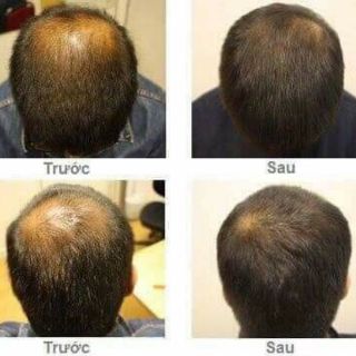 Xịt bưởi mọc tóc MAHAAD Thái Lan