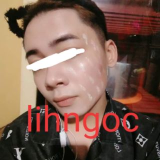 (💥CHÍNH HÃNG) Serum trị mụn Secret Life (hàng sẵn có).