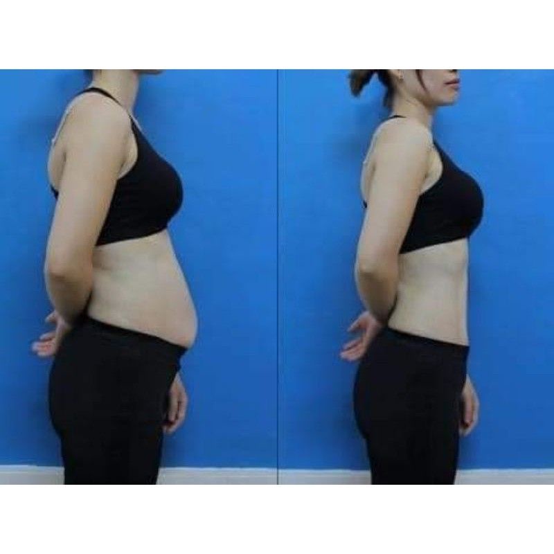 Đai Quấn Nóng Giảm Béo, Đai Giảm Mỡ Bụng Kết Hợp Rung Massage 3 Cấp Độ, Dùng Trong Spa Và Cá Nhân Tại Nhà