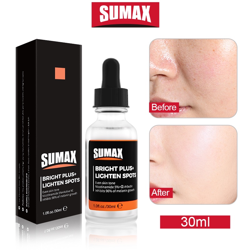 Serum SUMAX chứa Niacinamide 10% và kẽm 1% giúp cân bằng và làm săn chắc da 30ml