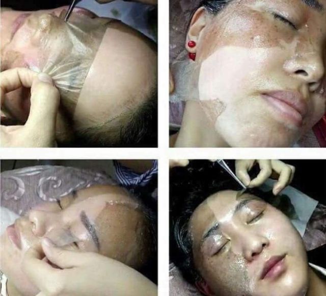 Mặt nạ màn tế bào gốc GoGo giá sỉ - Mặt Nạ Màng Tế Bào Gốc Trắng Da Xóa Nám GoGo