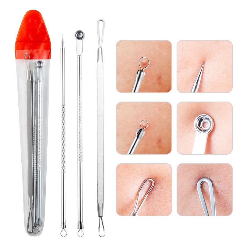 Nhíp Nặn Mụn Đầu Đen Bằng Thép Không Gỉ