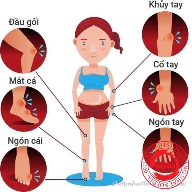 Viên uống hỗ trợ phòng chống và giảm Gout Anserine Minami Nhật Bản