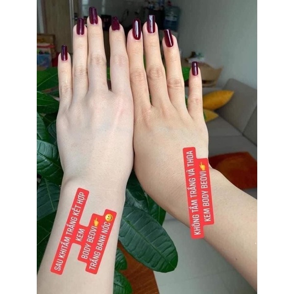 [CHÍNH HÃNG] KEM DƯỠNG BODY BEOVI TOO WHITE CA SỸ THU THUỶ, DƯỠNG ẨM SIÊU TRẮNG DA 7 NGÀY, HỘP 220GR | BigBuy360 - bigbuy360.vn