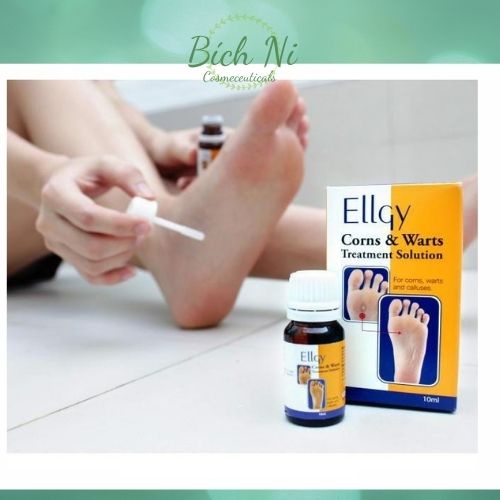 Dung dịch Ellgy Corns &amp; Warts loại sạch mụn cóc, mụn cơm, chai mắt cá chân.