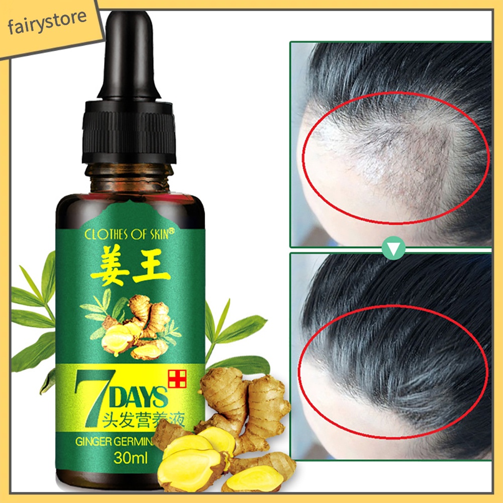 [Hàng mới về] Tinh dầu gừng kích thích mọc tóc an toàn hiệu quả trong 7 ngày