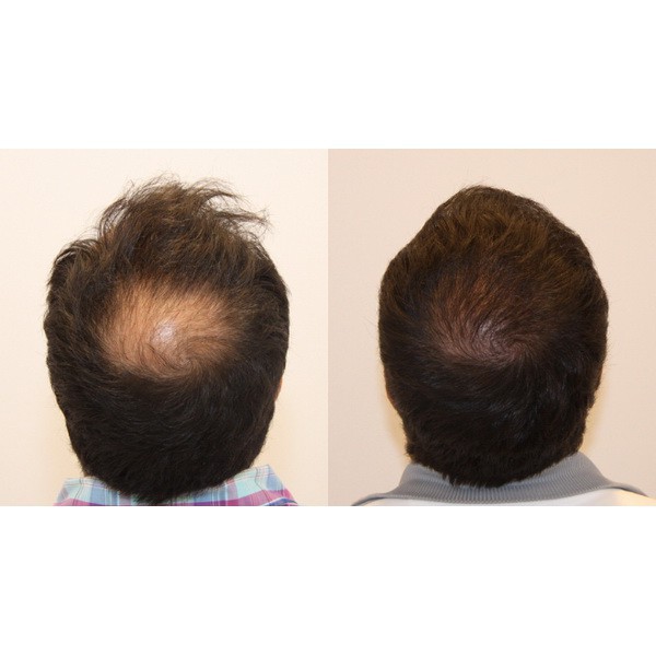 DẦU GỘI HỖ TRỢ NGĂN RỤNG TÓC RADICAL MED | BigBuy360 - bigbuy360.vn