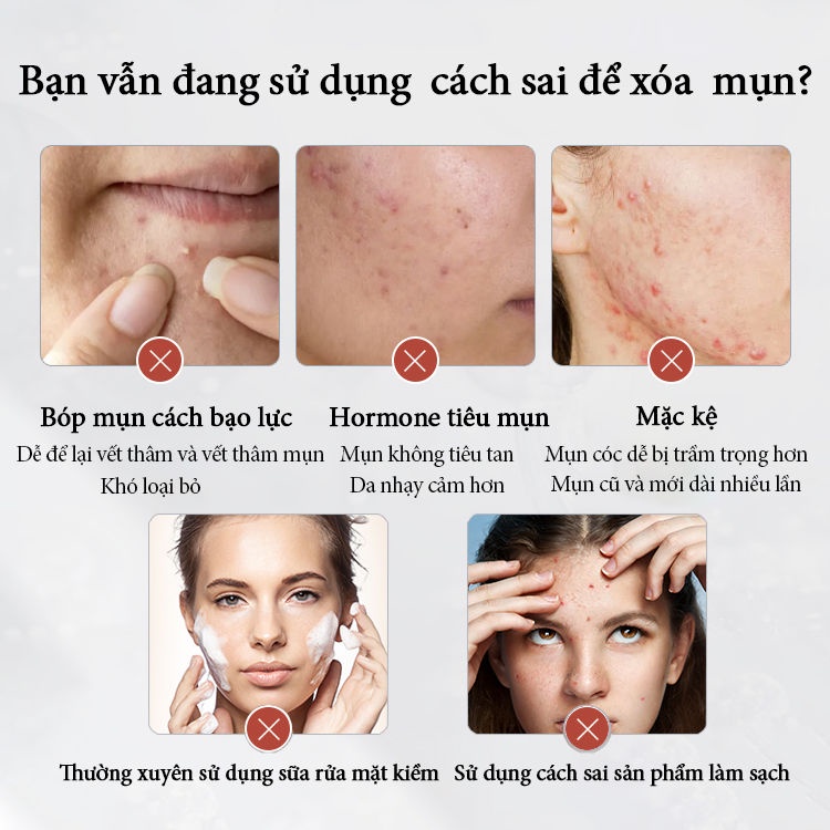 Kem Giảm Mụn Kem dưỡng giảm mụn mặt nạ giảm mụn kem trị thâm mụn mụn tàn nhang làm trắng dưỡng ẩm 30g