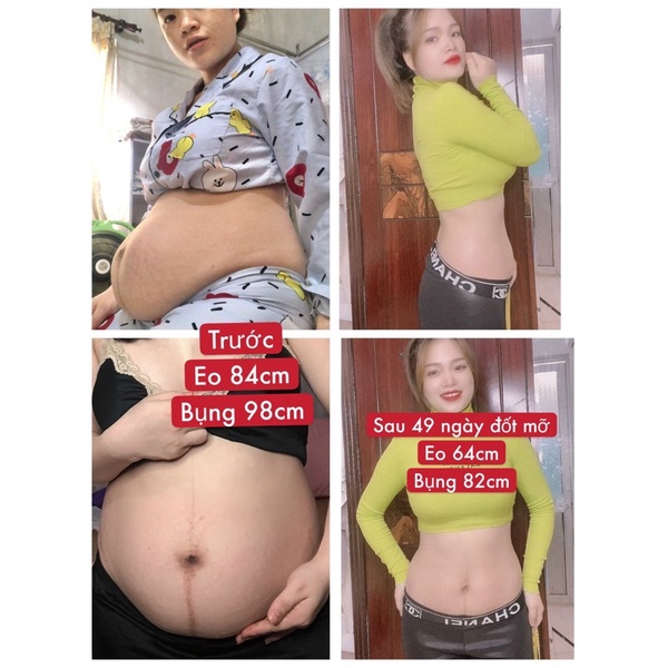 Bộ ủ nóng tan mỡ Slimming body | BigBuy360 - bigbuy360.vn