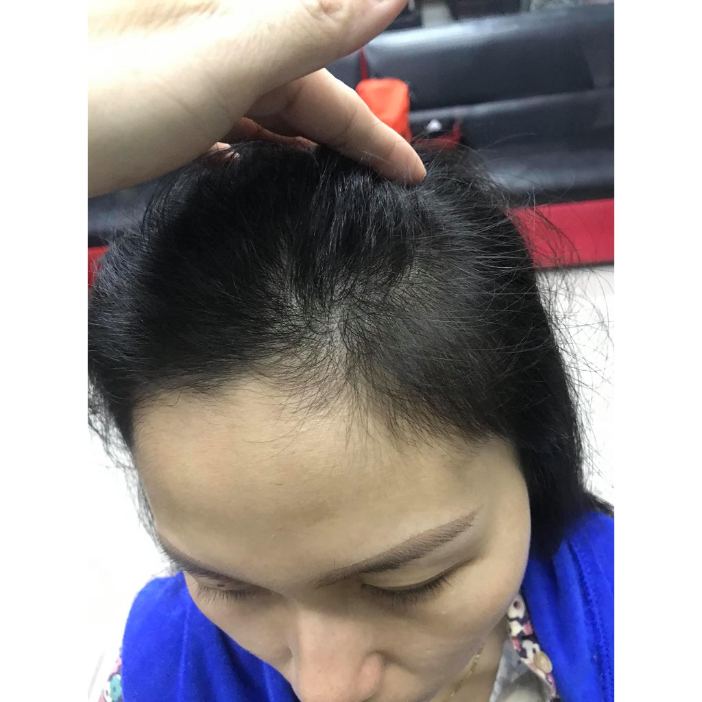 BỘ DẦU GỘI BƯỞI + TINH DẦU BƯỞI - Trị Rụng Tóc- Kích Thích Mọc Tóc NATULIFE | BigBuy360 - bigbuy360.vn