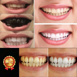 Bột Trắng Răng Smile Up Than Hoạt Tính