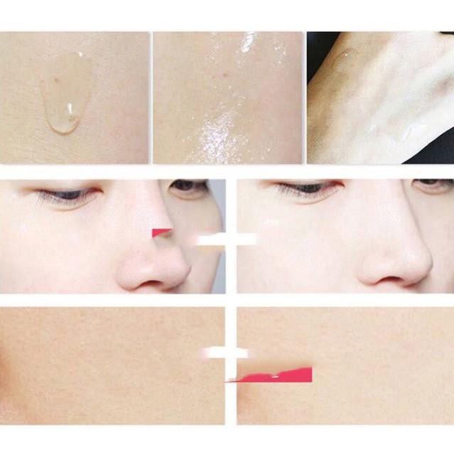 Serum Nhau Thai Cuống Rốn Royal LARGE Nhật Bản | BigBuy360 - bigbuy360.vn