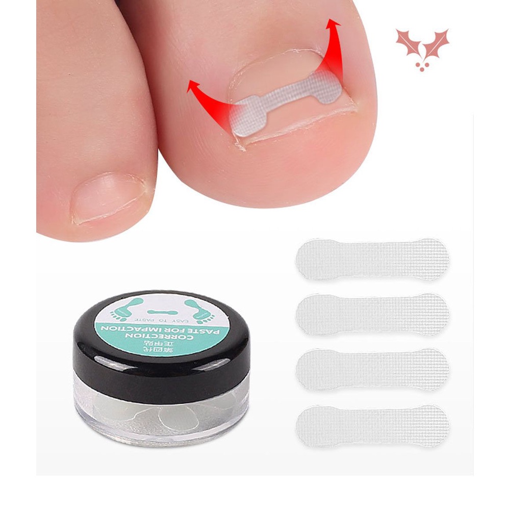10 Miếng dán chỉnh sửa móng chân mọc ngược co giãn tự làm