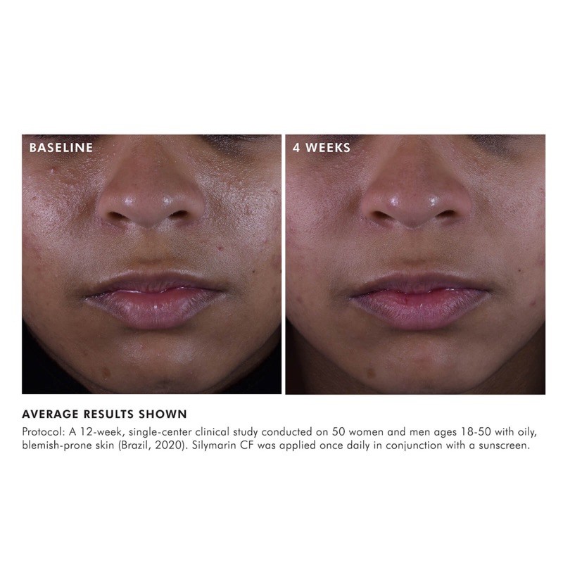 Skinceuticals SILYMARIN CF - Serum giảm mụn, ngăn ngừa tiết dầu, làm sáng da và chống oxy hoá cho da dầu/ mụn | BigBuy360 - bigbuy360.vn