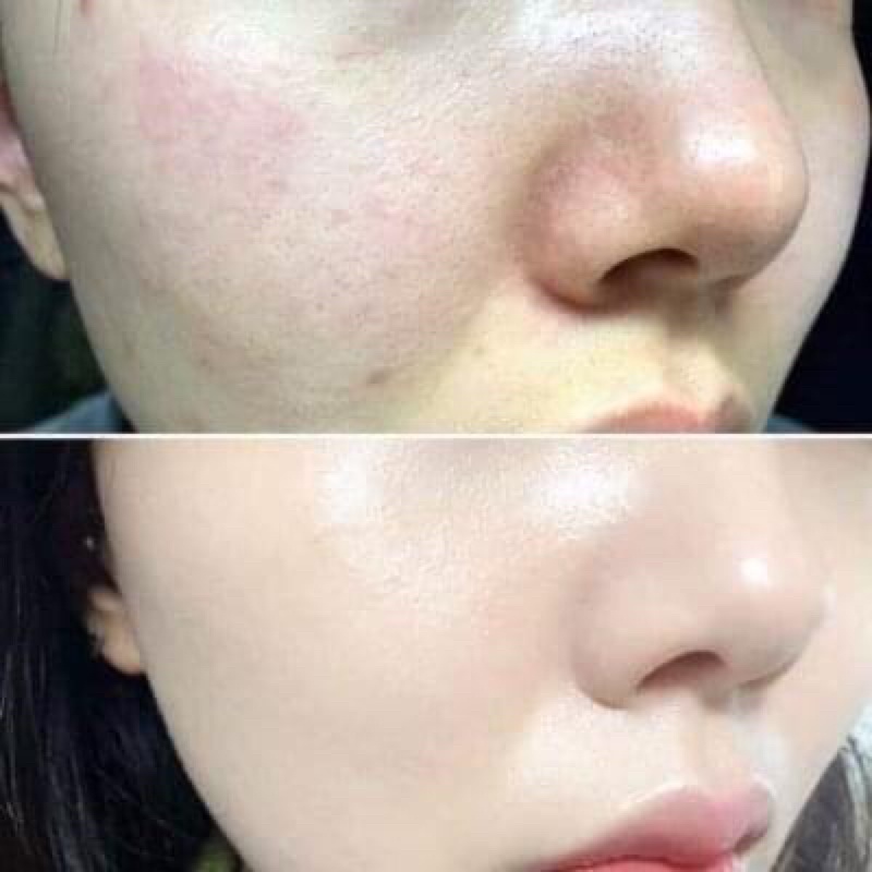 [CHÍNH HÃNG] Kem Dưỡng Trắng Mờ Thâm Nám Collagen Sữa Non Femmiu 30g