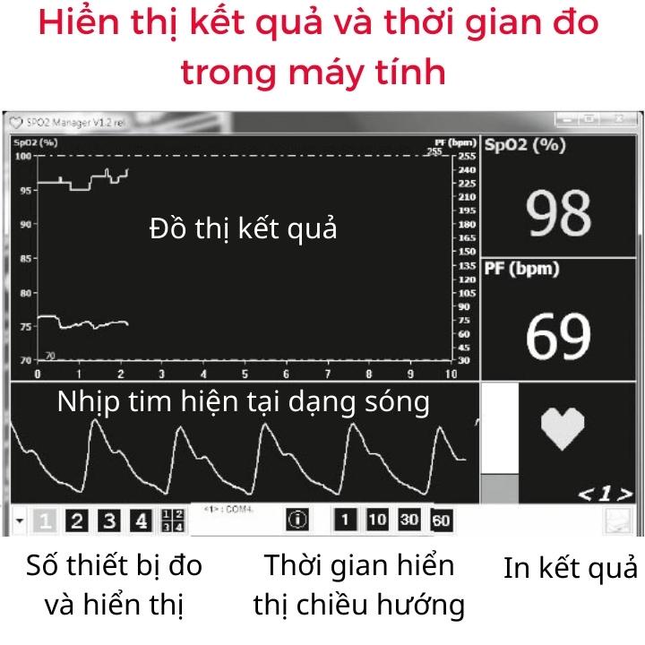 Máy đo nồng độ oxy (SPO2) và nhịp tim Beurer PO80 nhỏ gọn dễ sử dụng. Kết nối với máy tính, kèm sạc pin, không đau