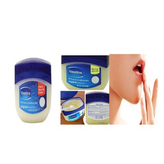 KEM DƯỠNG DA Vaselin 7GR  - MỸ